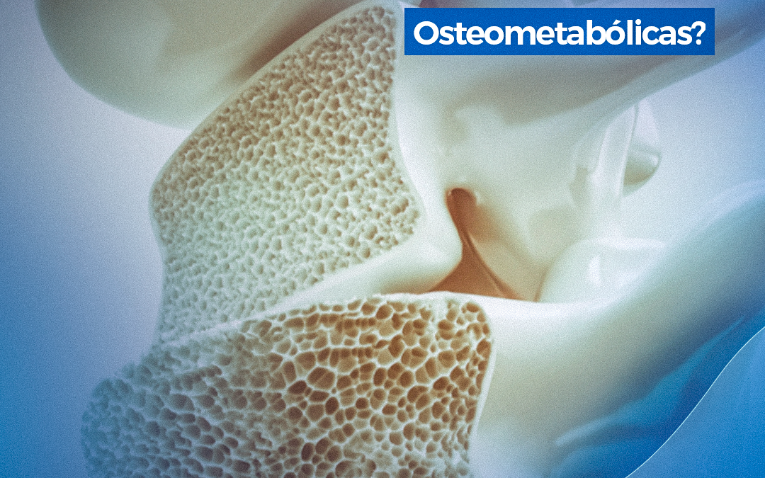 Você sabe o que são doenças osteometabólicas?